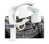 Ортопантомографы, купить в GREEN DENT, акции и специальные цены. 