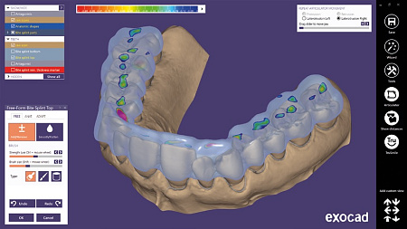 Exocad Bite splint module - модуль шинирования зубов